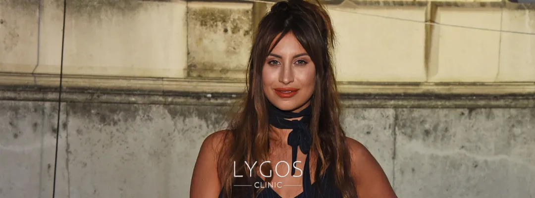Ferne McCann Rhinoplasty | Celebrities Nose Job 4 Why Celebrities Go for Nose Jobs Ferne McCann