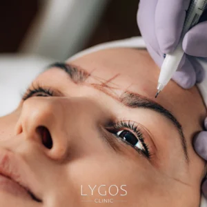 Eyebrow Transplant 20 Long-Term Effects of Eyebrow Transplantation