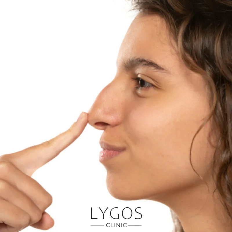 Nasal Tip Sagging and Its Causes