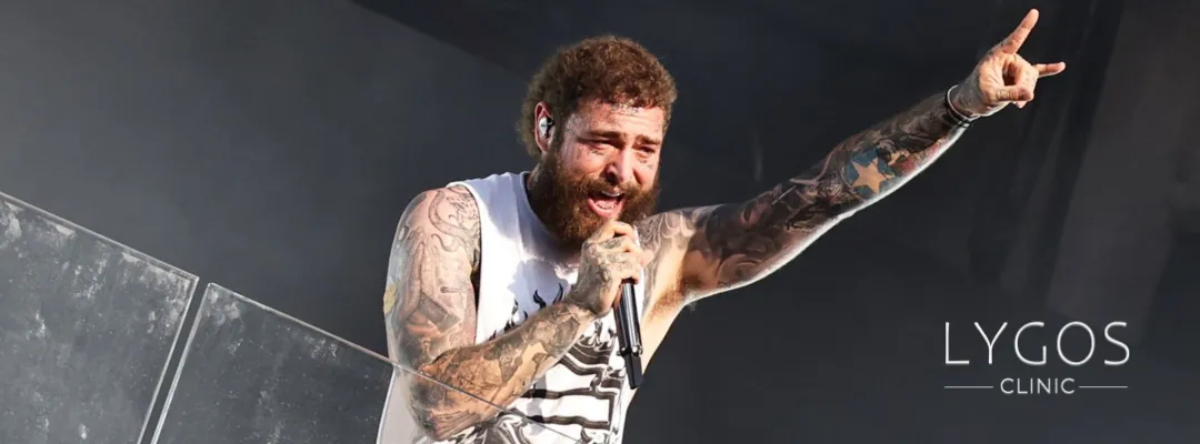 Post Malone Saç Ekimi Yaptırdı Mı?
