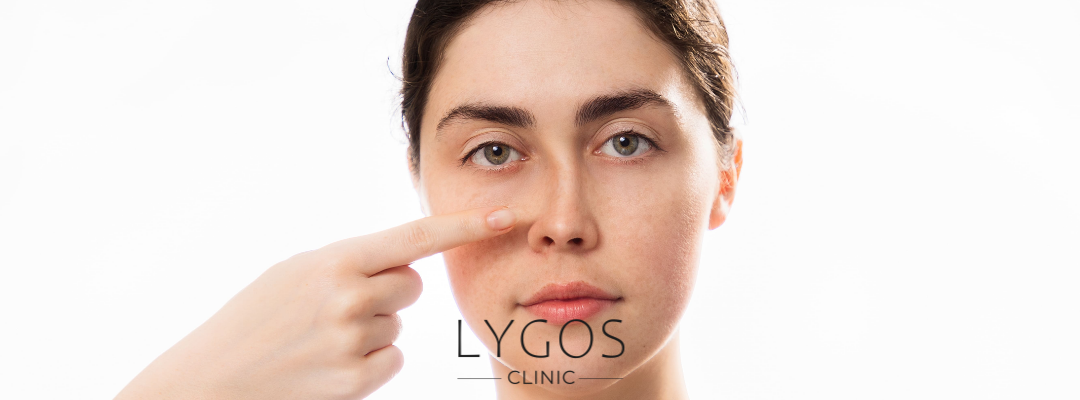What is Non-Surgical Nasal Aesthetics?