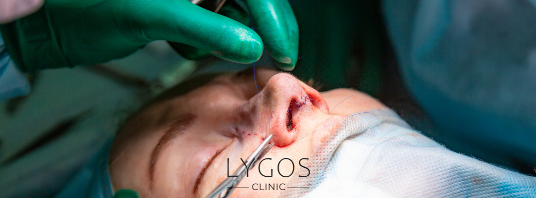 Swelling After Rhinoplasty | Causes and Solutions 2 Why Does Swelling After Rhinoplasty Occur?