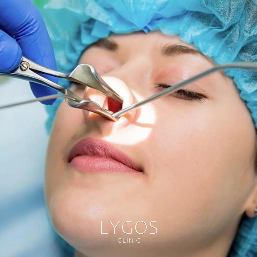 Nasal Turbinate Surgery | What Are the Risks? 1 Nasal Turbinate Surgery