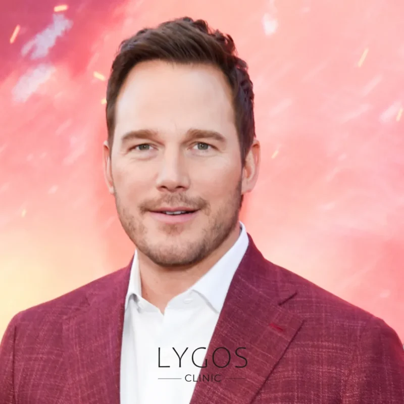 Chris Pratt Hair Transplant
