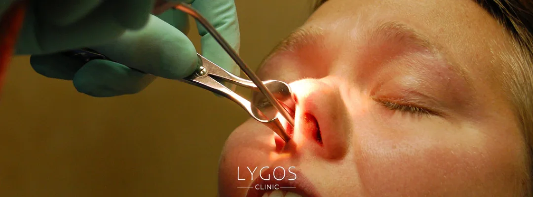 Nasal Turbinate Surgery Prices 3 How is Nasal Turbinate Surgery Performed?