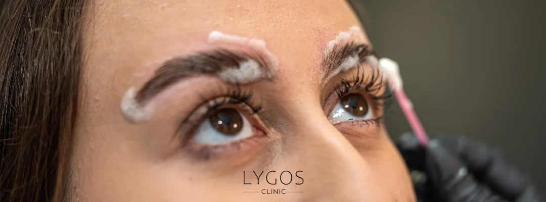 Things to Know Before and After Eyebrow Transplantation 4 When Does Swelling and Redness After Eyebrow Transplantation Go Away?