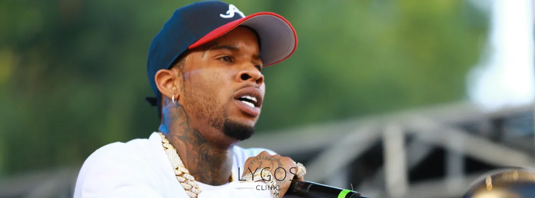 Tory Lanez Saç Ekimi | Ünlülerde Saç Ekimi 2 Who Is Tory Lanez?