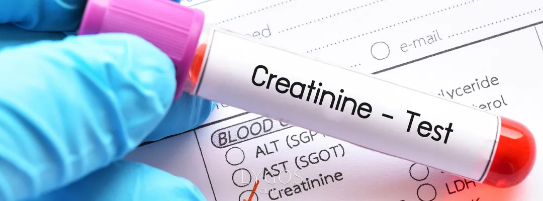What is Creatinine and What Does It Do?