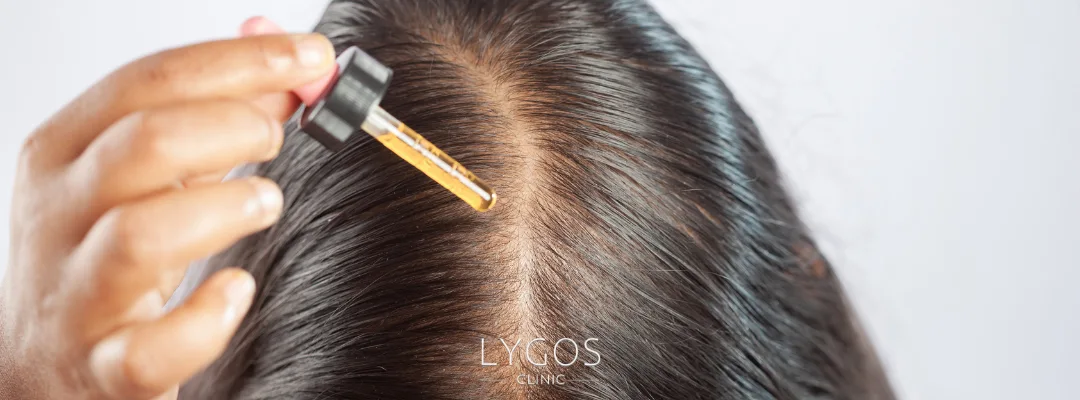 Treatment Methods for Alopecia Areata