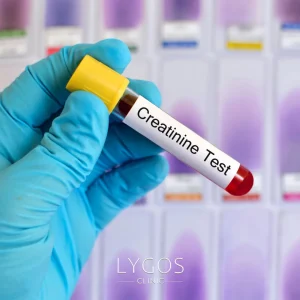 What is Creatinine