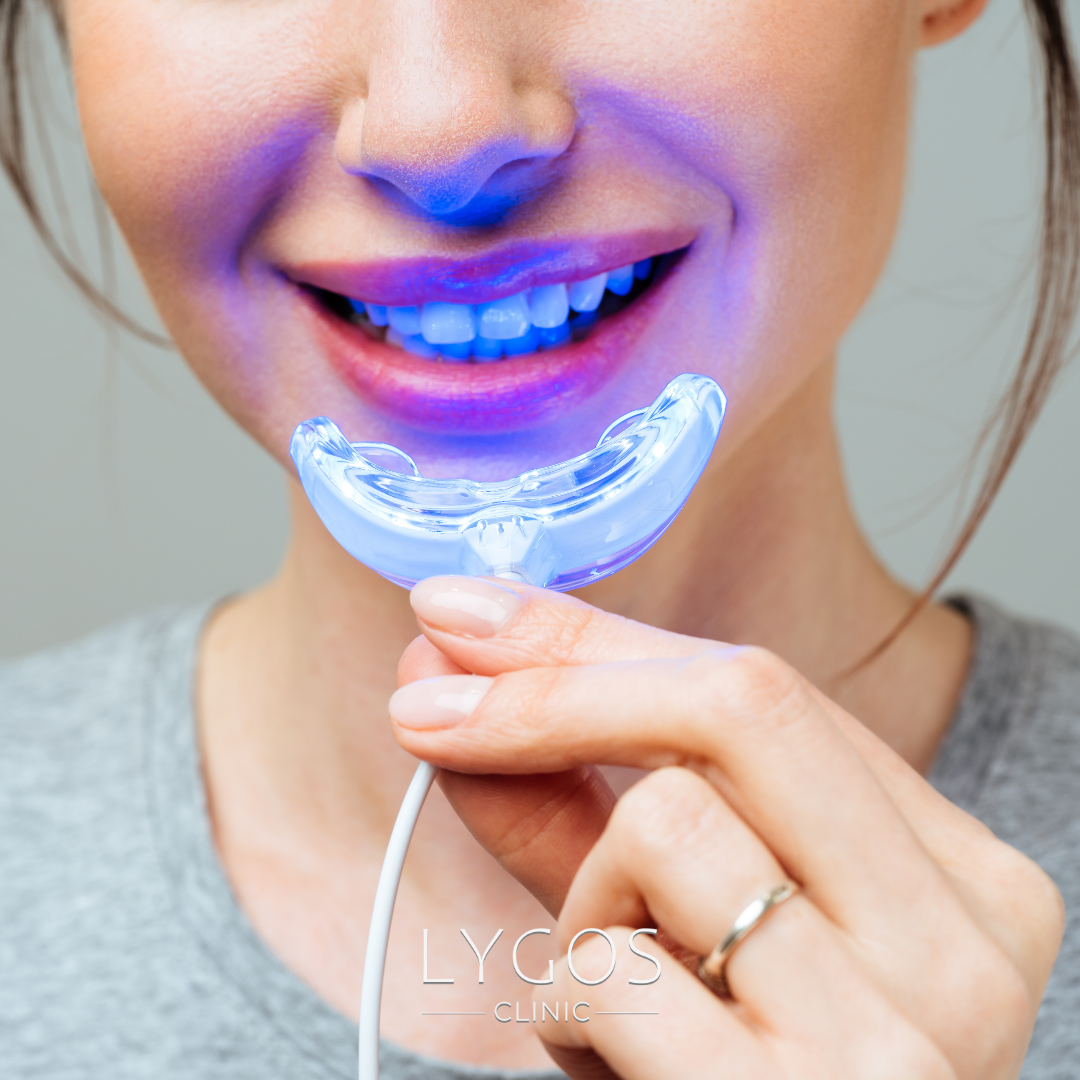 At-Home Teeth Whitening Methods