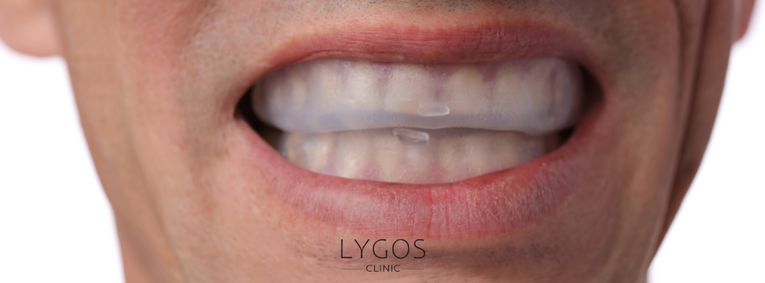 What Are the Most Common Mistakes in Dental Aesthetics?