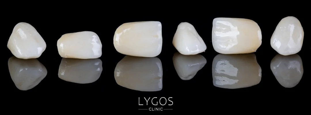 Factors Affecting Dental Treatment Prices in Turkey