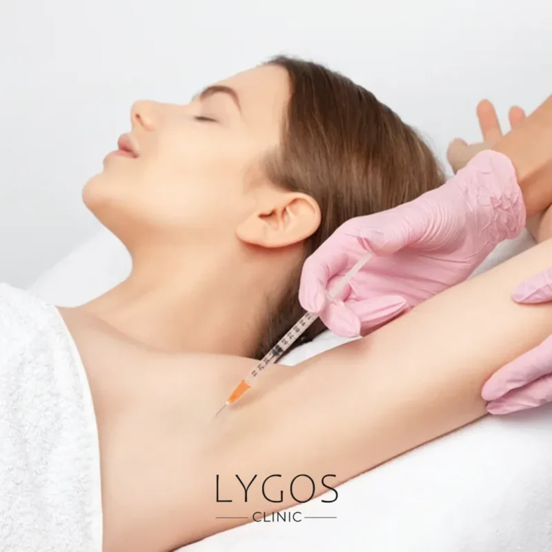 Botox Treatment for Excessive Sweating