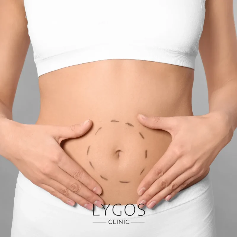 Tummy Tuck Surgery Prices