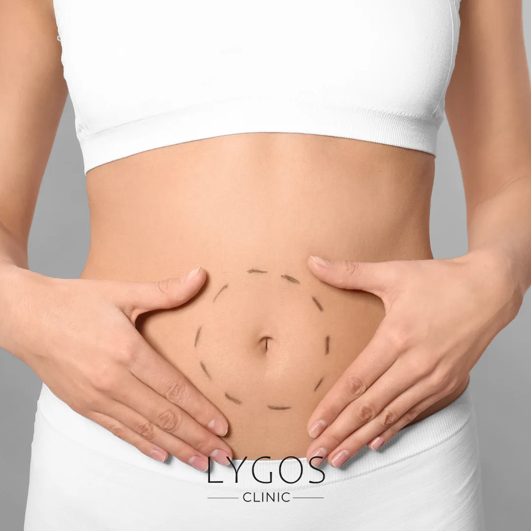 Tummy Tuck Surgery Prices