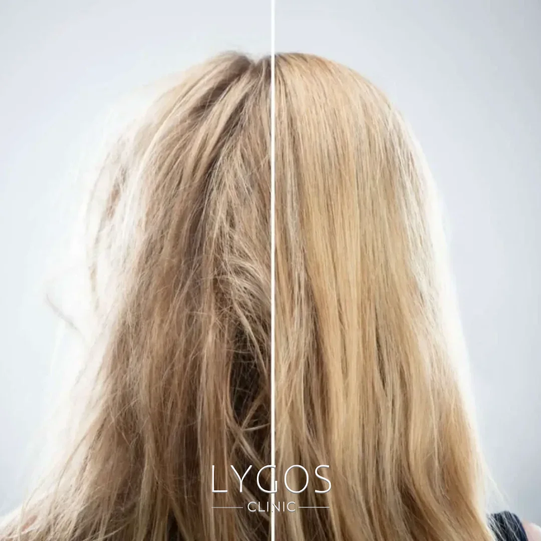 Saç Porozitesi Nedir? | Saç Porozitesi Nasıl Anlaşılır? 1 What Is Hair Porosity