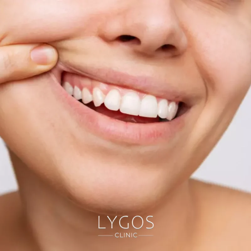 Common Mistakes in Dental Aesthetics