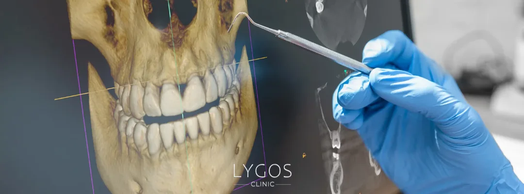 Oral and Maxillofacial Surgery in Turkey vs the United States 4 3 result 14