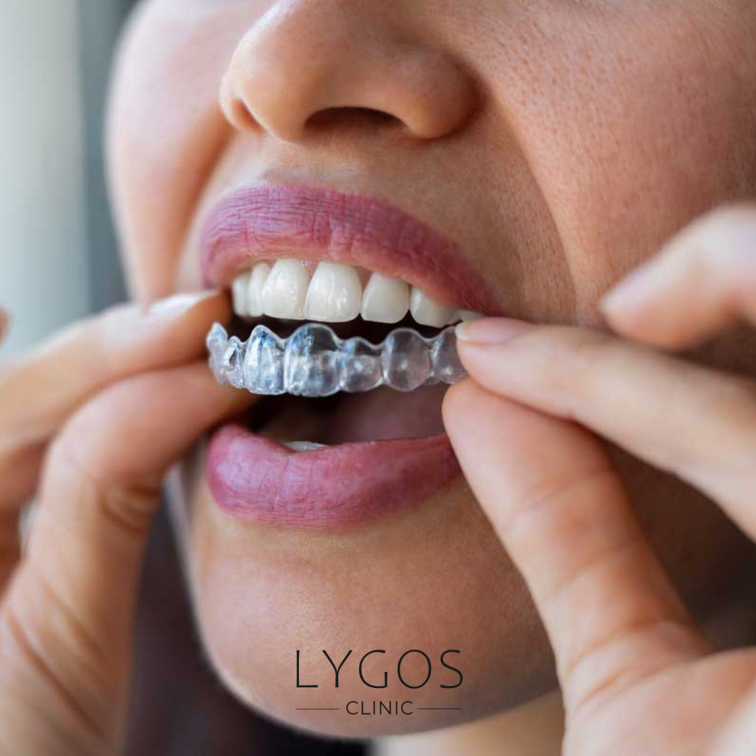 Invisalign Prices in Turkey vs UK
