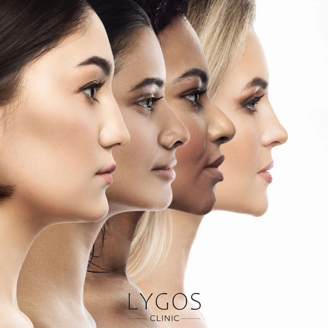 Nose Shapes by Ethnicity