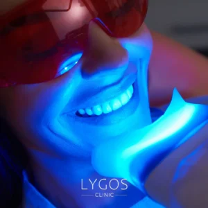 Nose Filling 25 Teeth Whitening Turkey vs UK