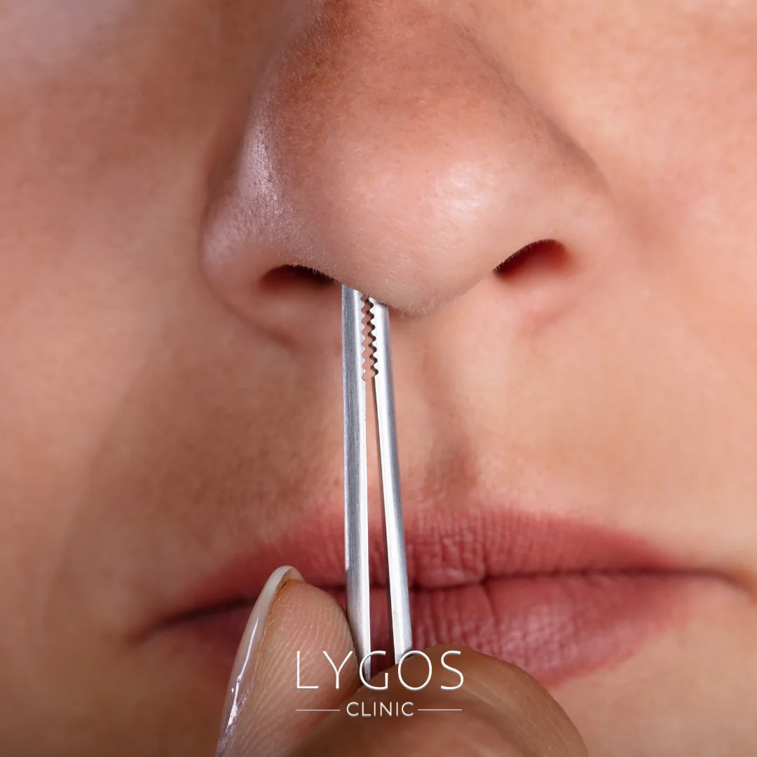 Is Plucking Nose Hairs Bad? | Health Risks of Plucking Nose Hairs 1 is-plucking-nose-hairs-bad