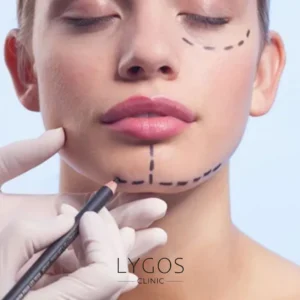 Hollywood Smile 36 Oral and Maxillofacial Surgery in Turkey vs the United States