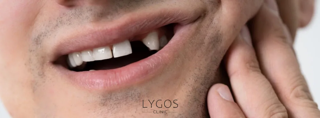 Aynı Gün Diş Tedavileri 4 3 result 28