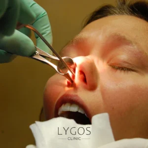 Réduction des cornets nasaux