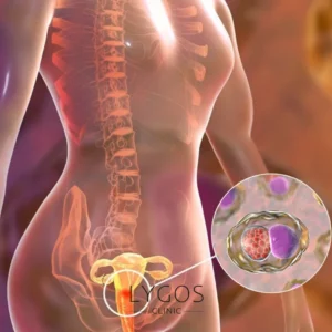 HPV and Cervical Cancer