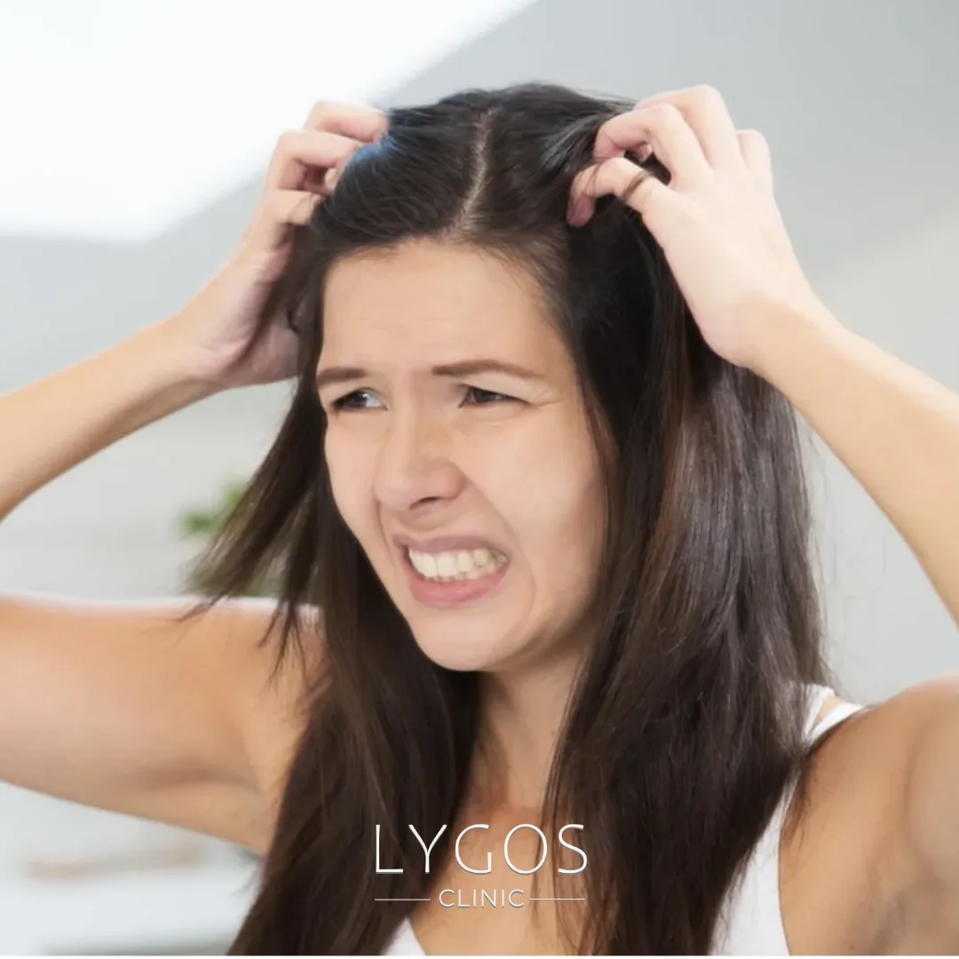 How to Get Rid of Scalp Itching? 1 How to Get Rid of Scalp Itching?