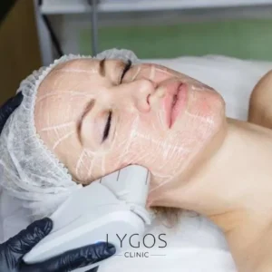 Teeth Whitening 27 HIFU and Fractional Radiofrequency