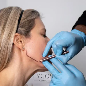 Gülüş Tasarımı 31 Jawline Enhancement