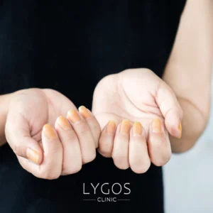 How to Get Rid of Yellow Nails
