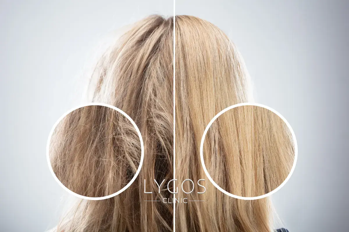 Benefits of Glycerin for Hair​