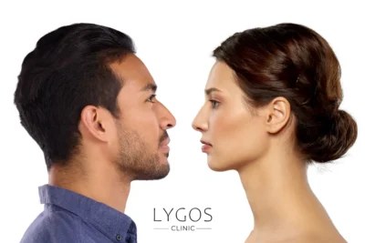 Smile Design 27 Differences-Between-Male-and-Female-Rhinoplasty