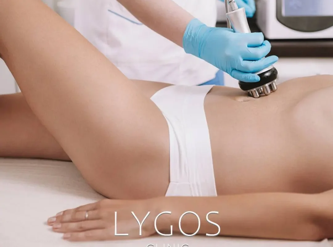 radiofrequency treatment_1 radiofrequency treatment